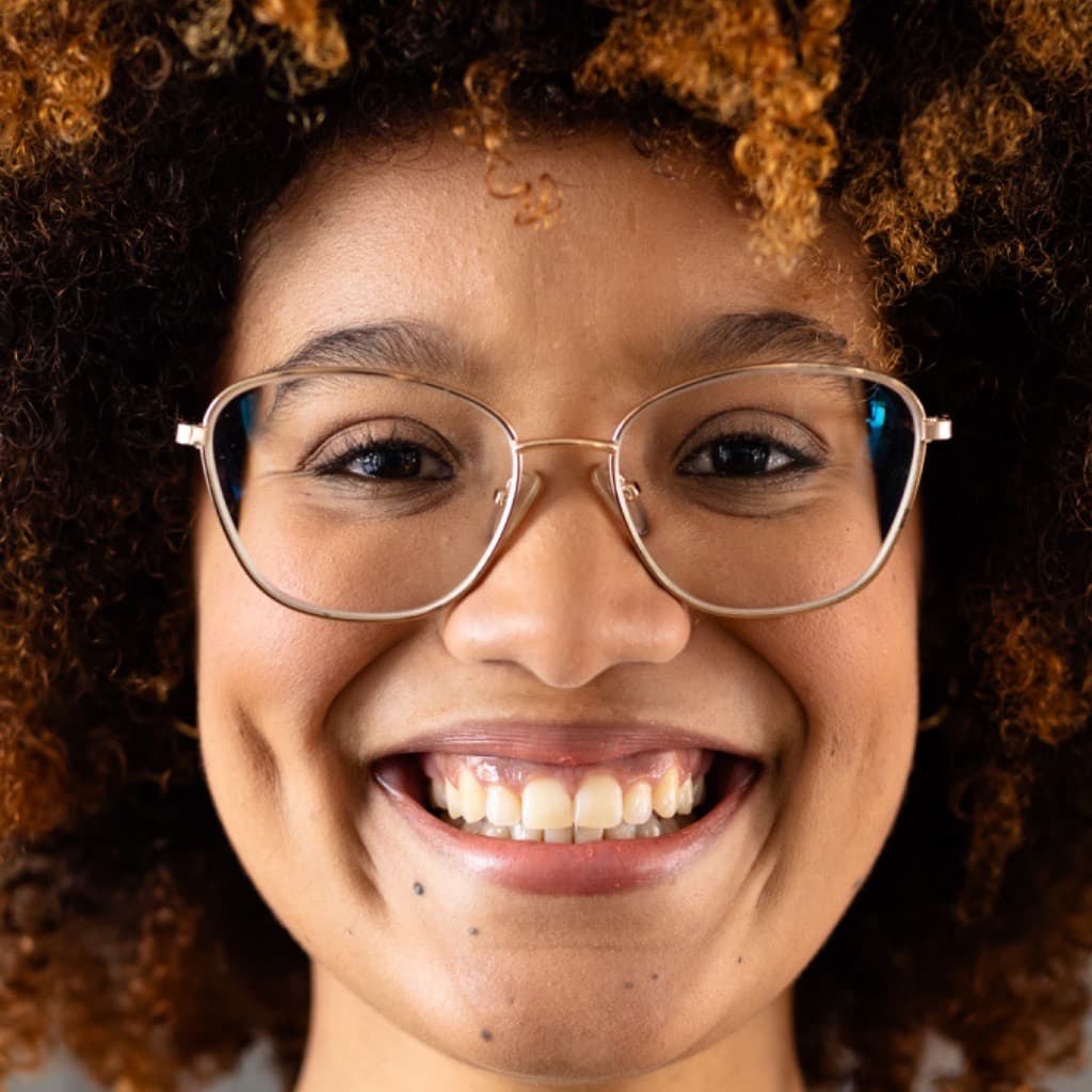 Original smile before procedure